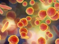 What Is Atypical Pneumonia?
