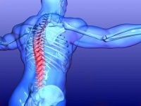 How to Identify and Treat an Ankylosing Spondylitis Flare-Up