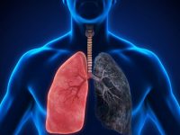 A natural lung cancer treatment? Researchers are testing a herbal supplement