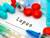 How Changing Your Diet Could Have a Major Impact on Managing Lupus Symptoms