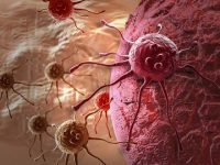 Researchers investigate psoriasis and adverse pregnancy outcomes