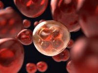 Lung cancer significantly affects the sexual health of women
