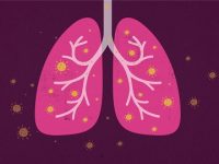 How Long Does a COVID Cough Last? Here’s Why It Can Linger for Some People