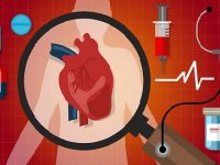 What are the signs and symptoms of a heart attack, as well as their risk factors?