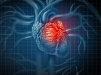 Cardiac Arrest: Causes, Symptoms, Diagnosis, and Treatment