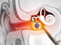 Ear Infections and COVID-19