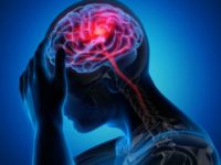 What Is a Chronic Tension Headache?