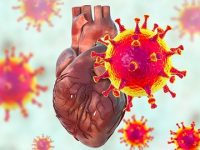 Cardiac inflammation after mild COVID-19 in previously healthy people