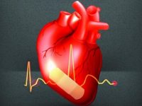 Persistent cardiac symptoms in individuals with mild initial COVID-19