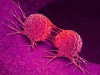 Prevention of cardiovascular disease is important in cancer patients