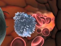 Why Viral Infections Are More Severe in People with Down Syndrome