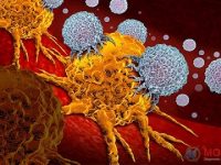 Did the COVID-19 pandemic exacerbate existing racial discrepancies in the diagnosis of different cancers?