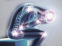 Postherpetic Neuralgia Prevalence and Treatment Approaches
