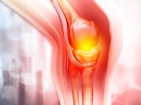 5 Causes Of Joint Pain That Might Not Be Arthritis