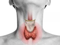 What Is Cobblestone Throat?