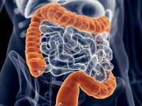 Chronic Inflammatory Bowel Disease: What Are They And Who Do They Affect?