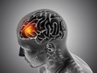 Depression Side Effects: Shrinking The Brain To Causing Inflammation, Chronic Depression Can Permanently Damage Your Brain