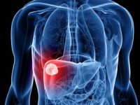 Fatty liver disease adversely affects brain health: Study