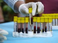 New Blood Test May Detect Alzheimer’s Long Before Symptoms Start