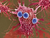 Reprogrammed tumor cells could teach the body’s immune system to fight cancer