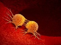 Failed cancer therapy revived as powerful tumor killer when combined with newer drugs