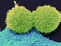 Breast Cancer By A New Name: Redefining Disease For Better Patient Outcomes