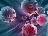 New sensor may be deployed to screen patients for hard-to-diagnose cancers