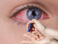 Under-Eye Swelling: Causes, Symptoms And Treatments