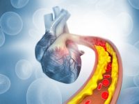 Can a blood clot cause a stroke?