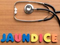 Yellowing Of The Eyes: Understanding Jaundice And Its Impact On Eye Health