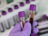 Predicting Kidney Disease in People with Diabetes