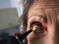 What Are Cataracts? Symptoms, Causes And Risks