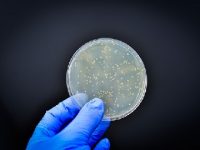What is E. coli? Everything you need to know about the bacteria behind the recent Calgary outbreak