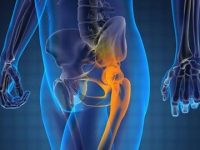 Prostate Cancer: Understanding the Basics, Risk Factors, and Symptoms