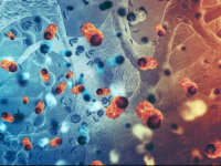 World Pancreatic Cancer Day: Symptoms, Risk Factors, Diagnosis, Treatment And More