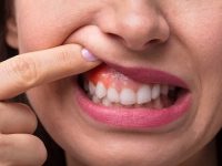 Mouth cancer deaths rise: Causes, symptoms and how to get a check-up for it