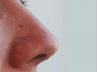 Body odor fingerprint: How your unique smell could help reveal cancer or COVID infections