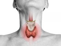 How to Lose Weight with Hypothyroidism